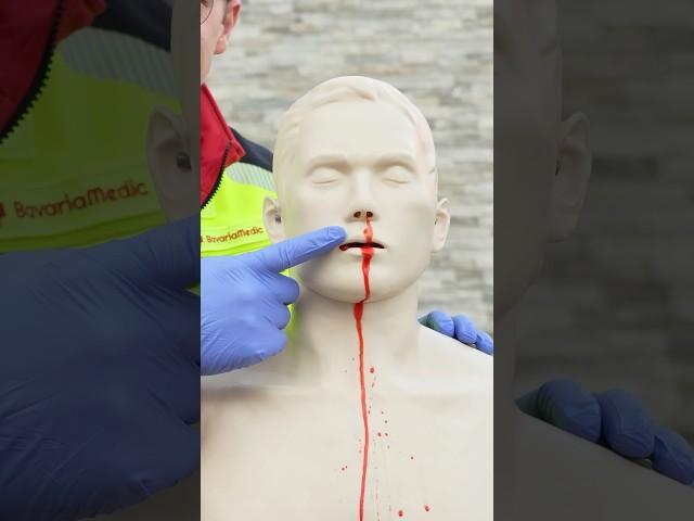 First Aid for Nosebleeds 🩸 #ambulance #firstaid #paramedic #hospital #emergency #nurse