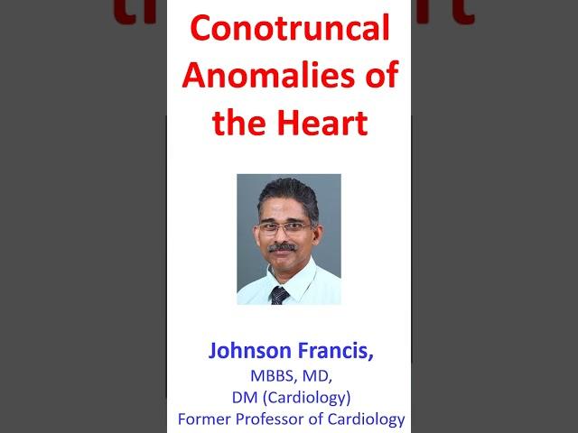 Conotruncal Anomalies of the Heart