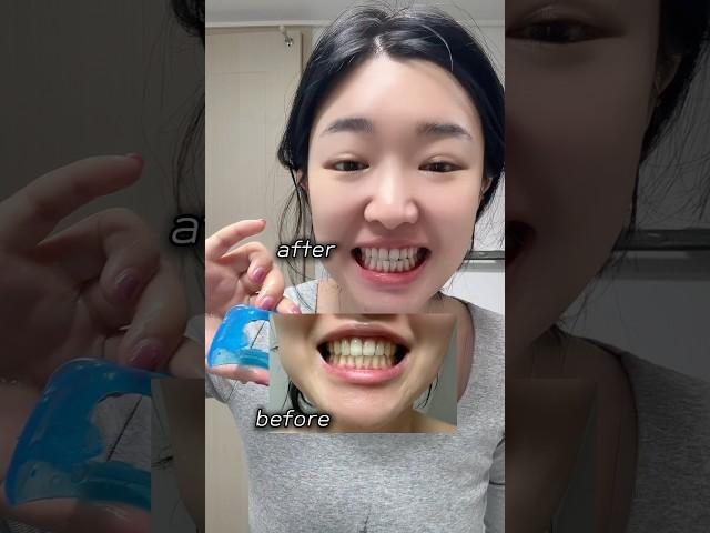 누렁니에서 흰니되기.. #화이트랩스 #공구중 #치아미백 #예비신부관리