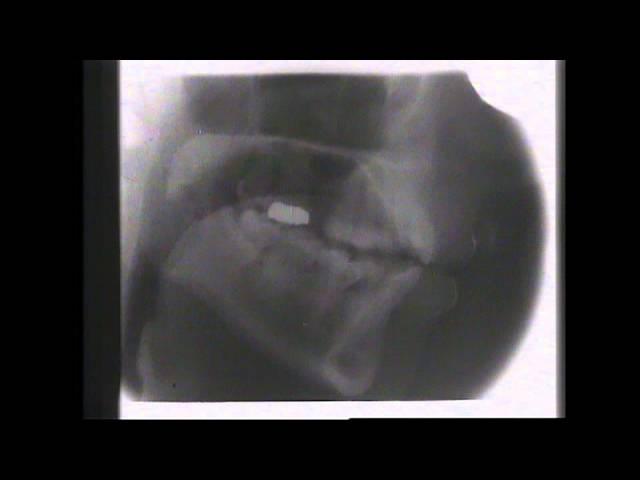 Kevin Munhall Xray Database 2
