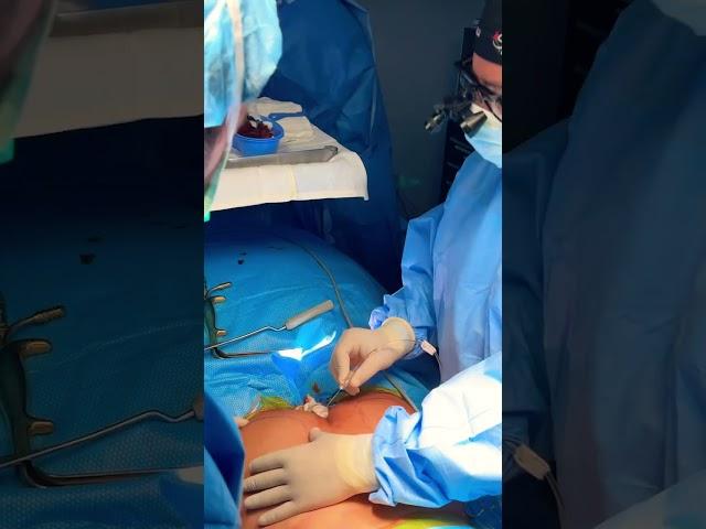 Buttock implant surgery now live-streaming: Watch incredible transformations with Dr. Jeneby