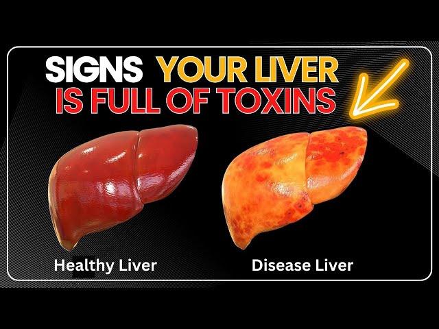 10 Signs Your Liver is Full of Toxins