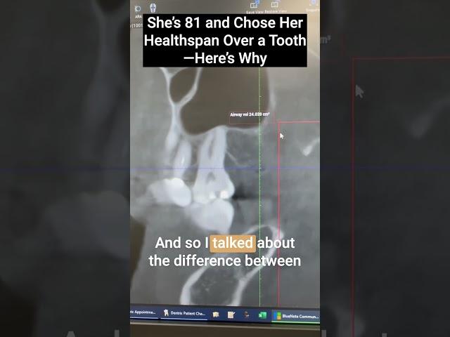 She’s 81 and Chose Her Healthspan Over a Tooth—Here’s Why #shorts