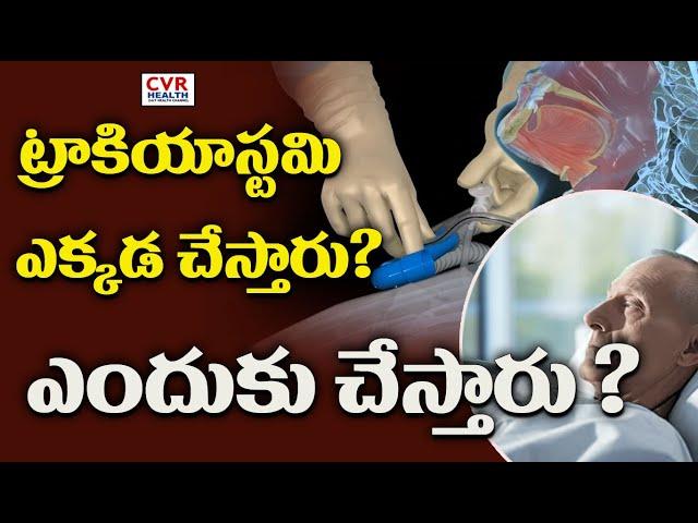 ట్రాకియాస్టమి ఎక్కడ చేస్తారు?ఎందుకు చేస్తారు ?|tracheostomy| CVR Health