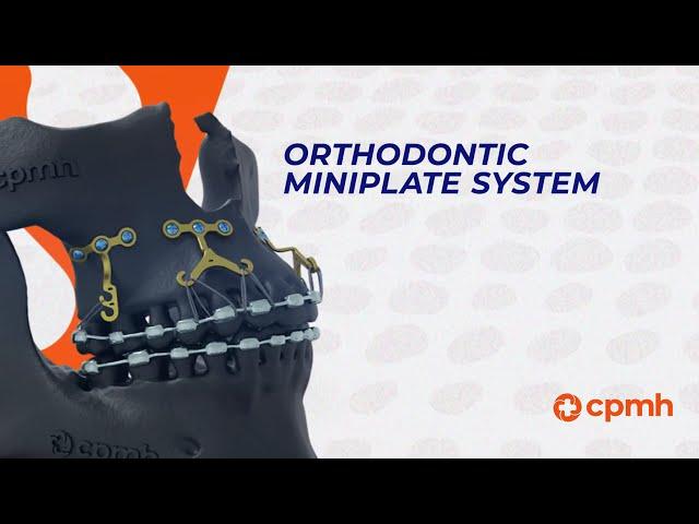 Ancorfix - Orthodontic Miniplate System - CPMH