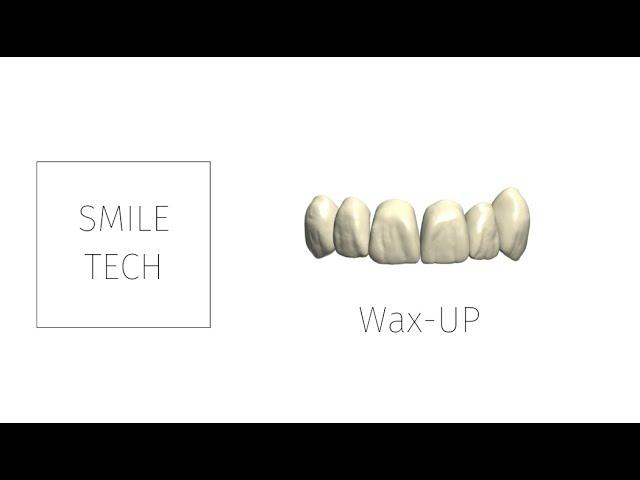 Digital Dental Wax UP