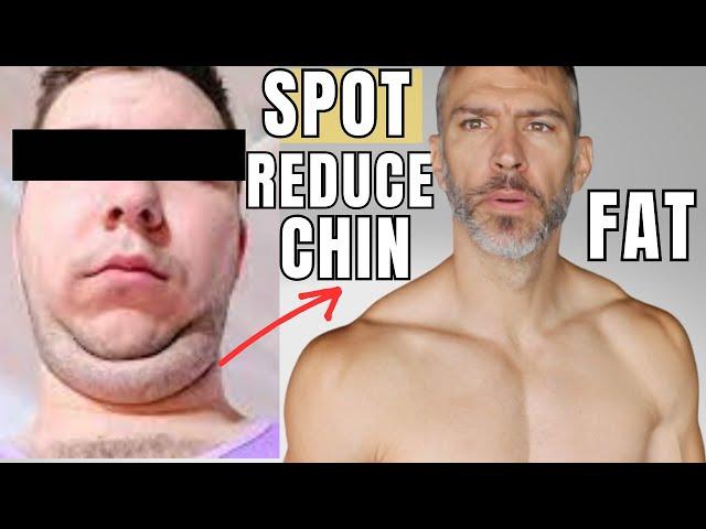 Double Chin Fat Gone | No Surgery | Stubborn Fat Loss