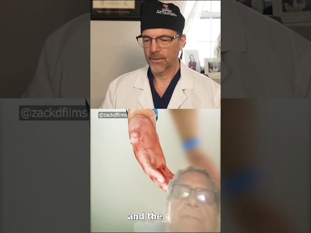 Now a hand transport works  Surgeon reacts #utube #greenscreen #short #hand