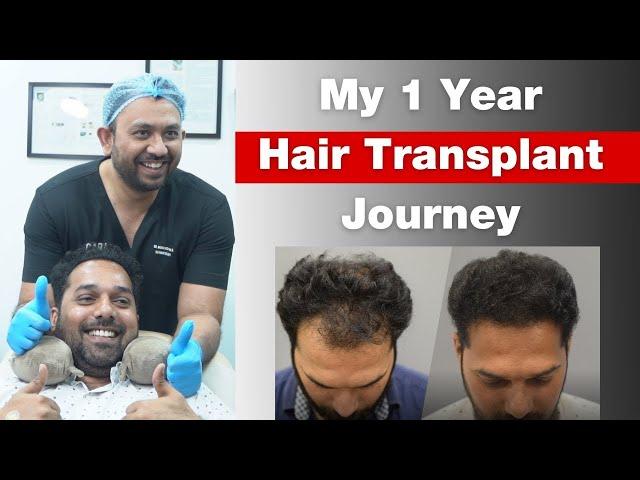 Best Cost of Hair Transplant in Mumbai: Do your research! #hairtransplantcost