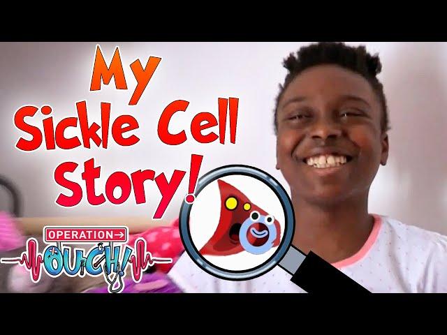 Bolu's Sickle Cell Anaemia Story 🩸 | Ouch Patients | Operation Ouch