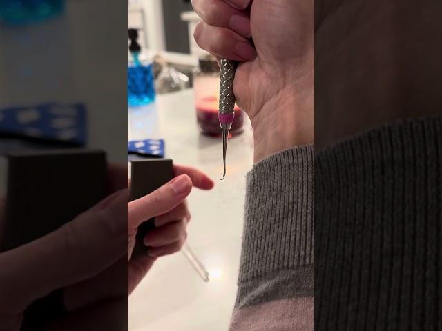 Anterior sickle left-handed sharpening