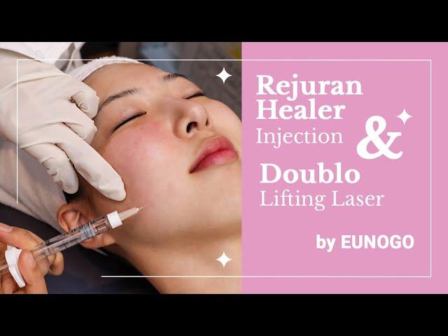 Rejuran Healer Injection and Doublo Lifting Laser | How It's Like | Before & After  | Eunogo Beauty