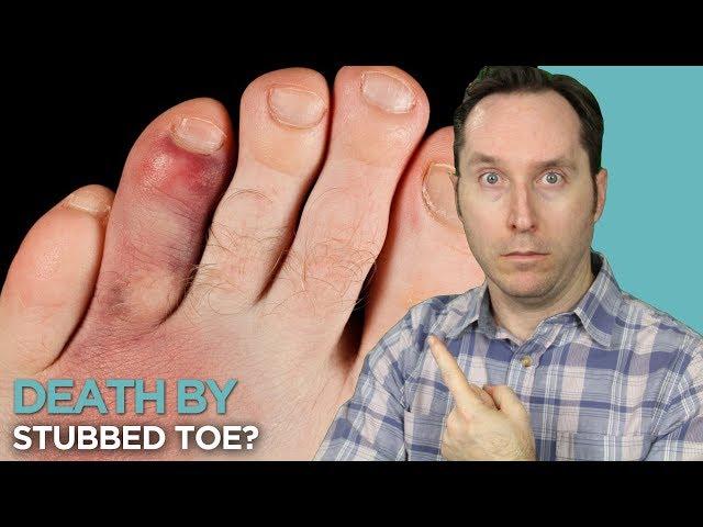 10 People Who Died From Incredibly Minor Injuries | Random Thursday