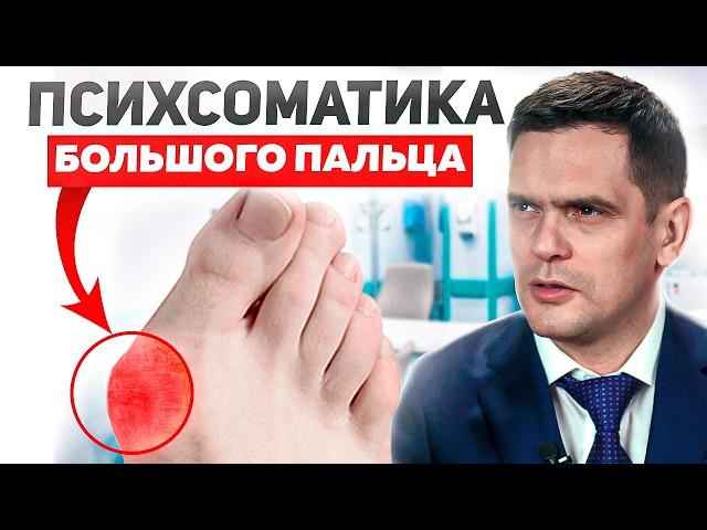 Психосоматика Большого Пальца ноги: Откуда берется "Шишка" На Ноге, Искривление, Грибок