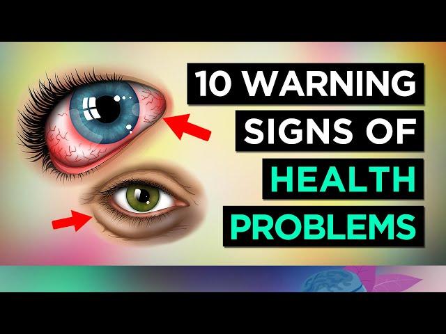 10 Warning Signs Your EYES are TELLING YOU About Your HEALTH.