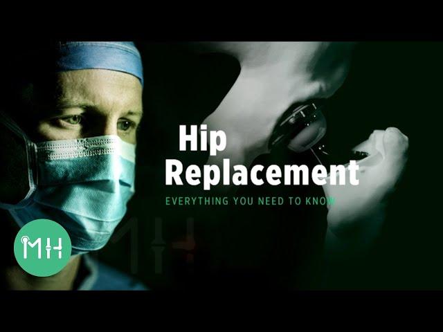 Hip Replacement - Everything you need to know