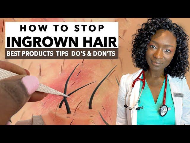 How to Stop Ingrown Hair & Razor Bumps from Waxing & Shaving | Treatments & Products | Black Skin