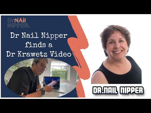 Dr Nail Nipper finds Dr Krawetz of Healthy Feet Podiatry video