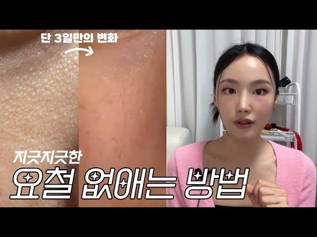 ENG CC) NOT SPONSORED How to get rid of bumpy skin *real before & after/product recs* 