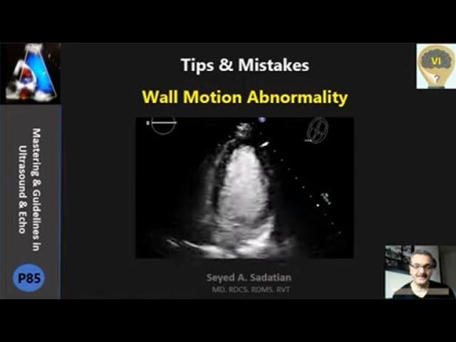 Tips & Mistakes: Wall Motion