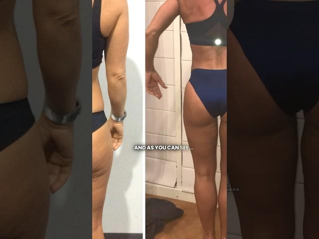 Say goodbye to stubborn cellulite #motivation #fatburningsecrets #carnivorediet #beforeandafter