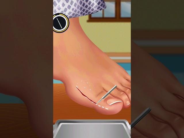 عملية جراحية #جراحة_العظام #جراحة #طب #طبيب Surgery #orthopedics #surgery #medicine #doctor