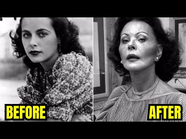 20 RARE Pre-Plastic-Surgeries in Old Hollywood History