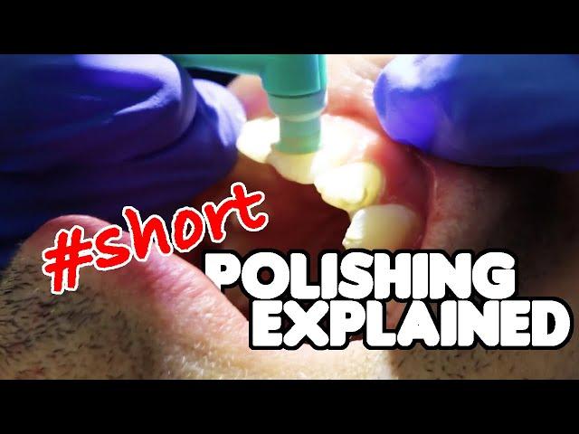 Dental Cleaning | Teeth Polishing Explained #shorts #dentalhygienist #teethcleaning