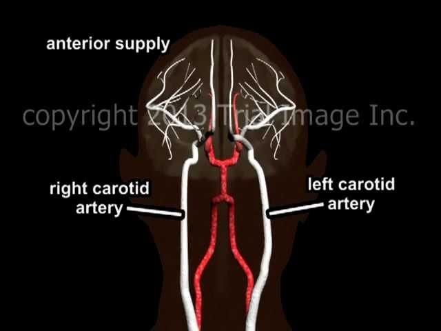 Blood Supply to the Brain - Animation and Narration by Dr. Cal Shipley, M.D.