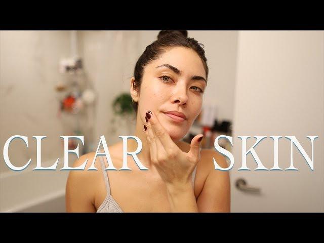 How I Cleared Up a Bad Breakout and Faded Post Acne Marks FAST | Melissa Alatorre