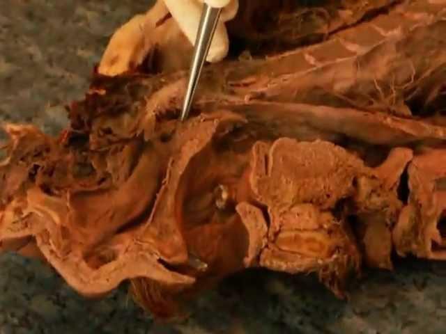 MNF Medad Team | Dr. Ayman Abdallah H&N Practical Anatomy [ Spotting 01 ]