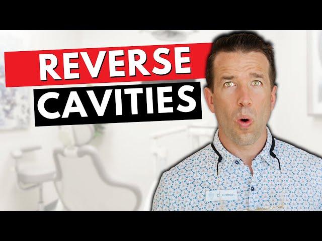 Dentist Debunks Cavities and Retainer