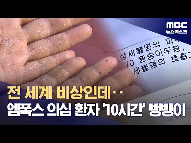 전 세계 비상인데 검사도 못하고‥'엠폭스' 의심환자 10시간 뺑뺑이 (2024.09.27/뉴스데스크/MBC)