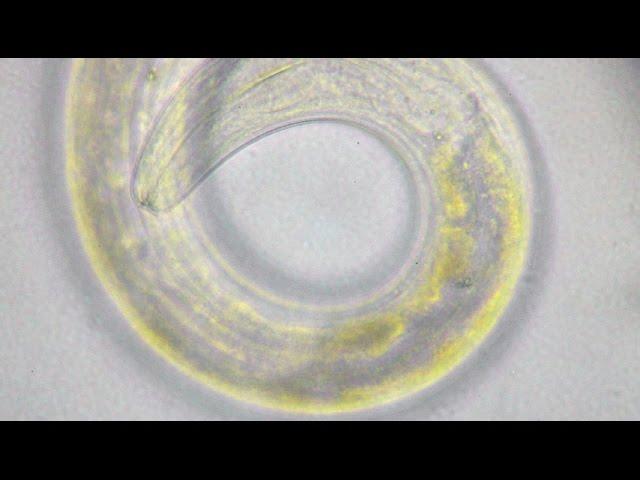 Nematode Diplogaster sp. and its developing Eggs