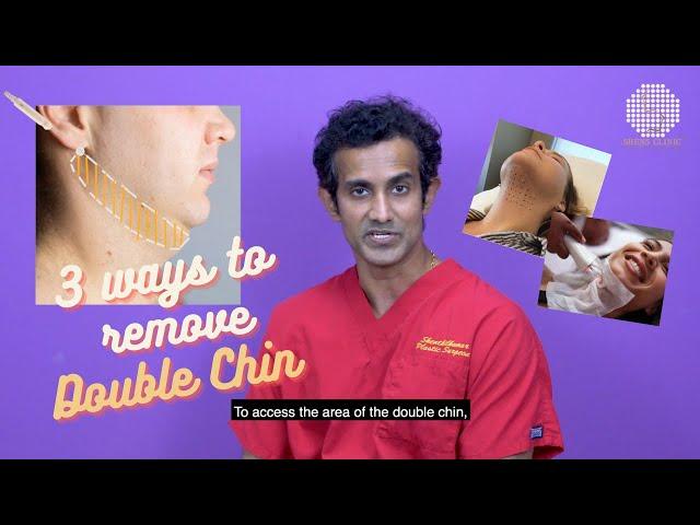 3 Ways To Remove Double Chin (Plastic Surgery & Aesthetic Treatments) #AskDrShens