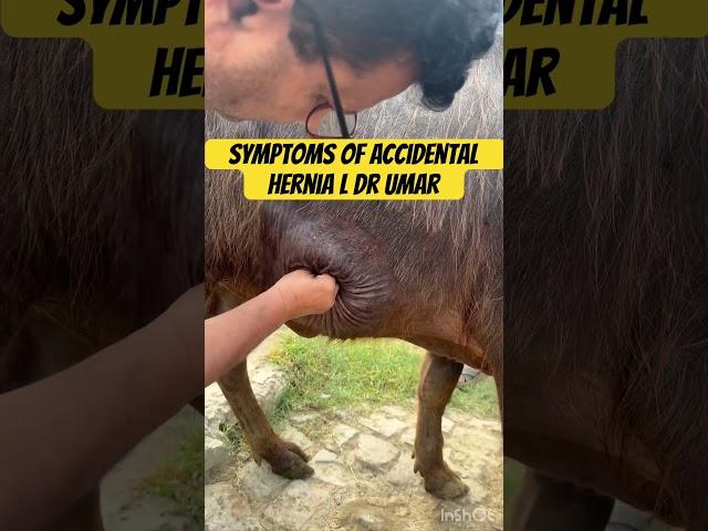 Symptoms of hernia l dr Umar Khan