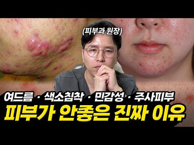 피부타입MBTI 5분만에 내 진짜 피부타입 확인하는법!