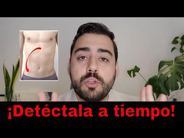 7 señales de que tu dolor de abdomen es apendicitis