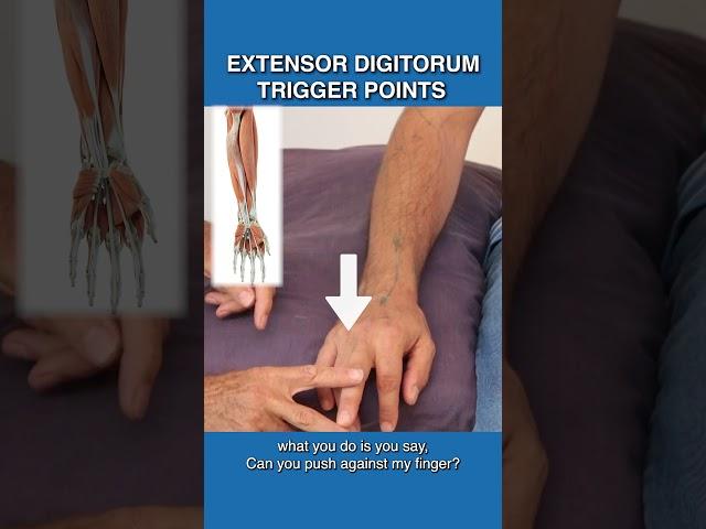 Are Trigger Points Causing Pain In Your Fingers?