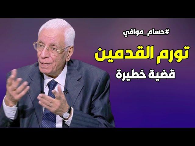 أسباب تورم القدمين وطرق علاجها .. د. حسام موافي: قضية طبية خطيرة جدا