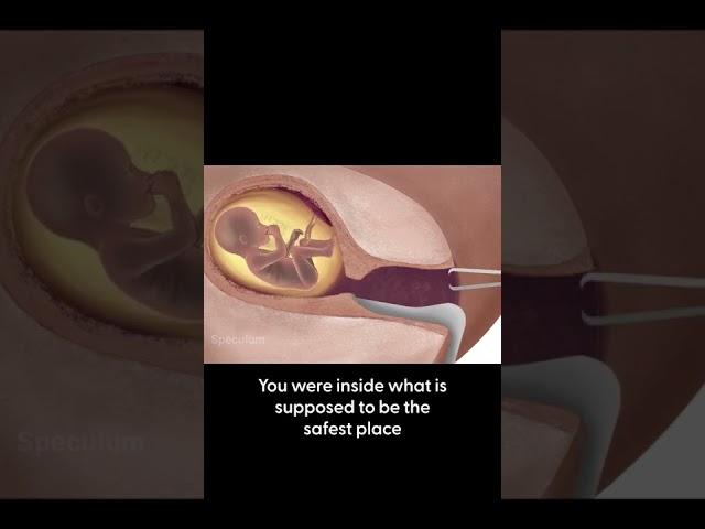 Abortion Is Not A Valid Choice - Killing A Child Is Wrong