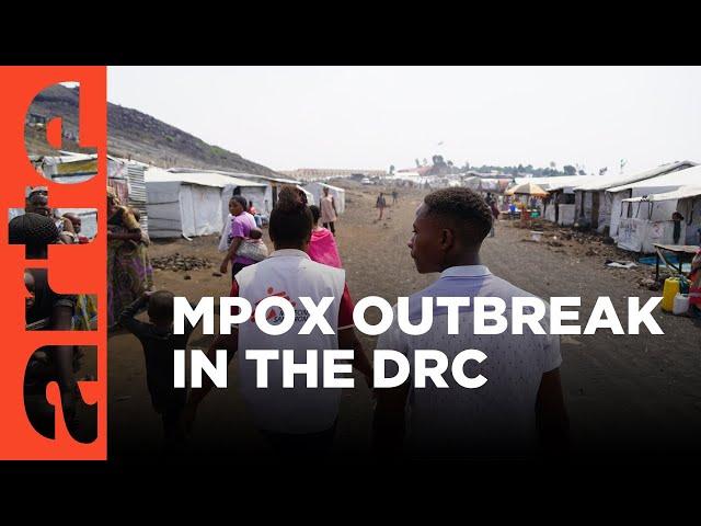 DRC: The Mpox Epidemic | ARTE.tv Documentary