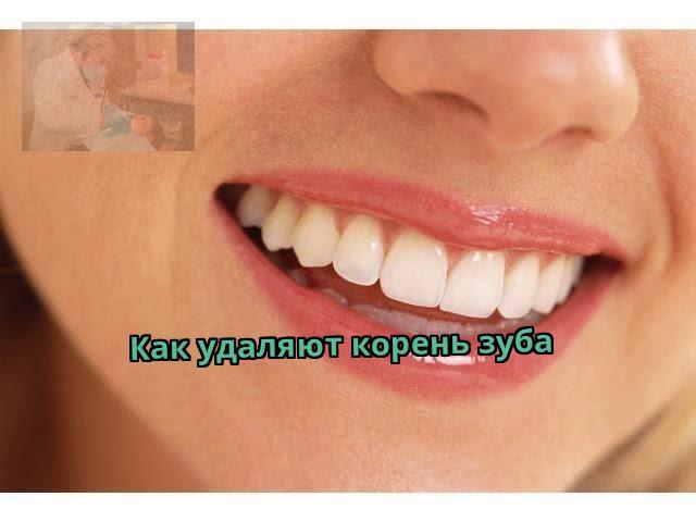 Как удаляют корень зуба