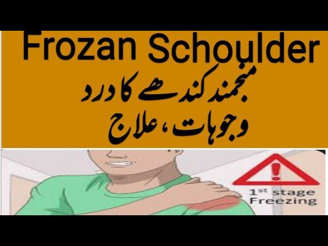 منجمند کندھے کا درد frozan schoulder ka ilaj