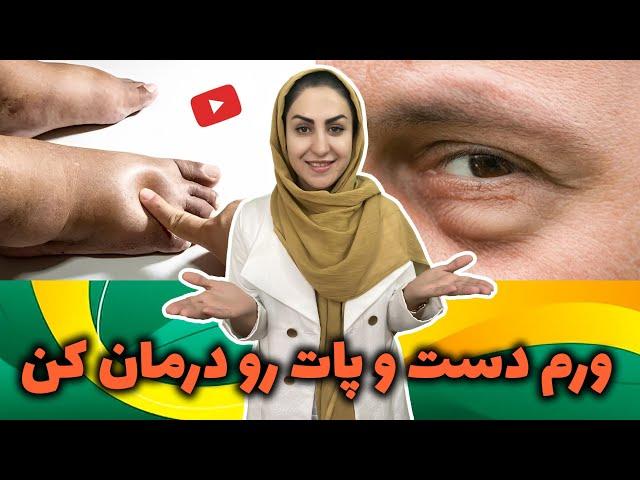 ورم دست و پات رو اینطوری درمان کن! | درمان ورم کل بدن، ورم دست، ورم پا، ورم زیر چشم و ...