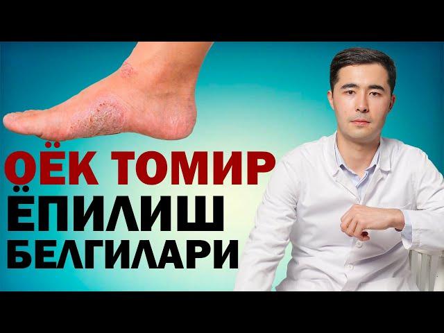 ОЁК ТОМИРЛАРИ ЁПИЛИШ БЕЛГИЛАРИ. КЕЧ БУЛМАЙ БИЛИБ ОЛИНГ