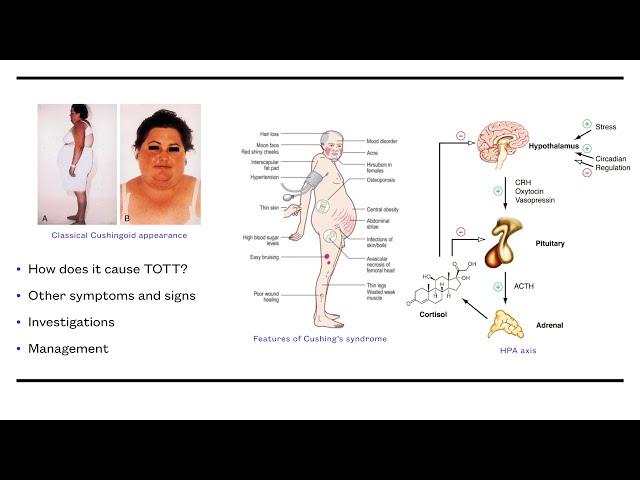 Elsevier Medical Mini Lecture: Tired All the Time