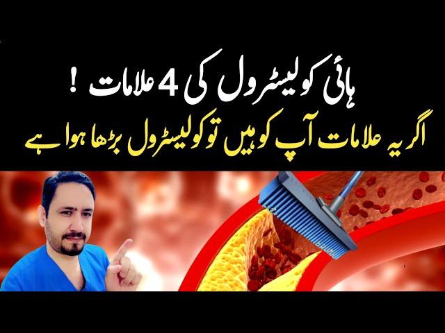 4 Warning Signs of High Cholesterol - Dr Irfan Azeem