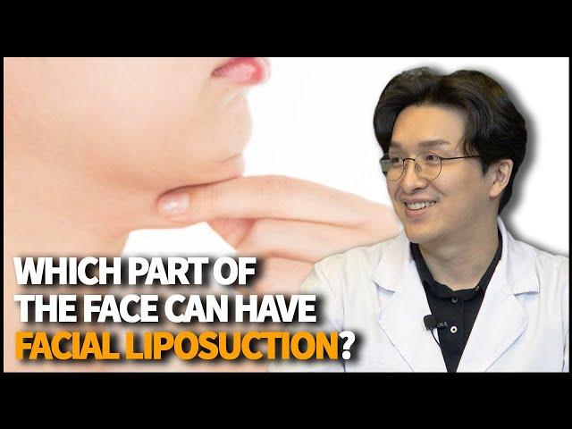 Which part of the face can have Facial Liposuction procedure?