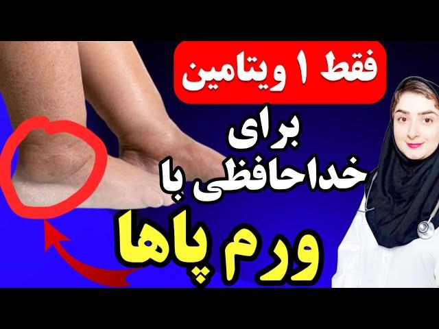فقط ۱ ویتامین معجزه آسا برای رفع دائمی ورم پاها،ساق پا و مچ پا _علت و درمان ورم پا